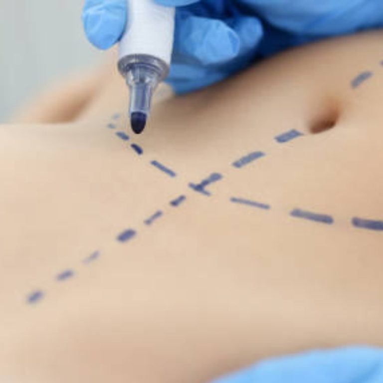 istockphoto-1349697037-612x612